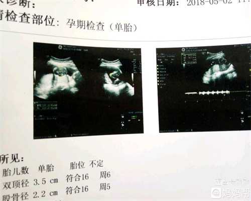 代孕29周胎儿在哪个位置_代代孕双胞胎多少钱
