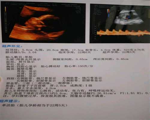 代孕39周胎心基线低胎儿呈反应形怎么回事_上海