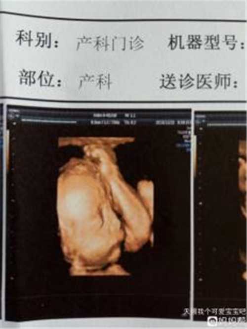 温州供卵试管_国内靠谱代孕那里有_试管婴儿早期常规体检项目有什么?